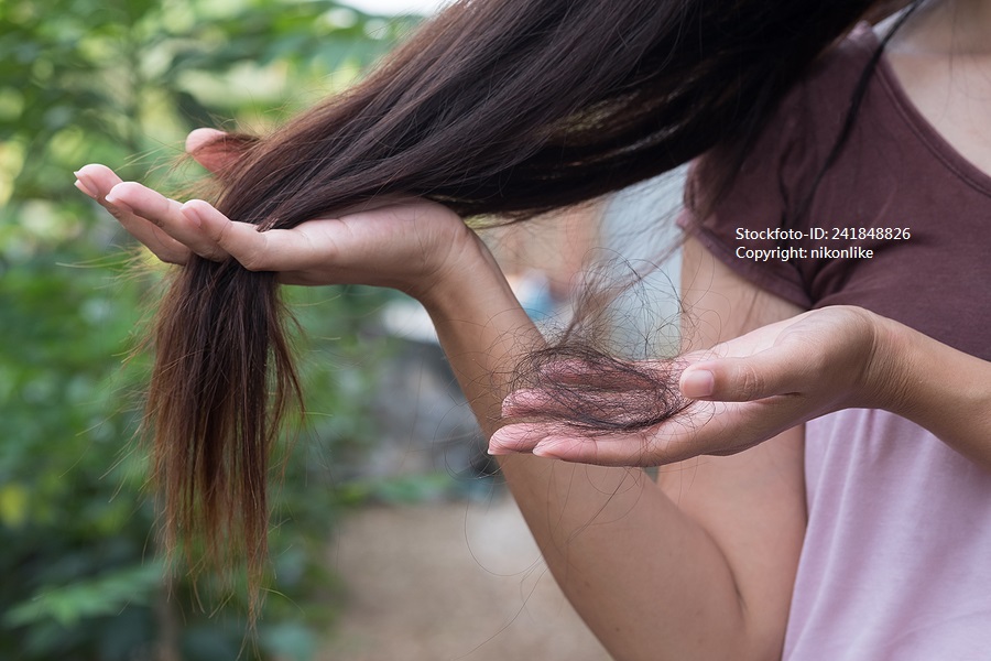 Haarausfall bei Chemotherapie