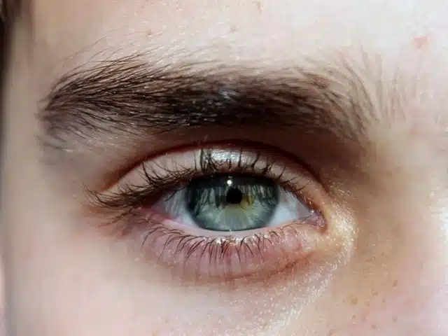 Augenbrauen Ausfall nach Chemotherapie