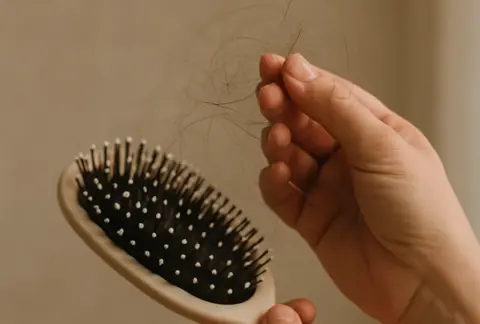 Diffuser Haarausfall