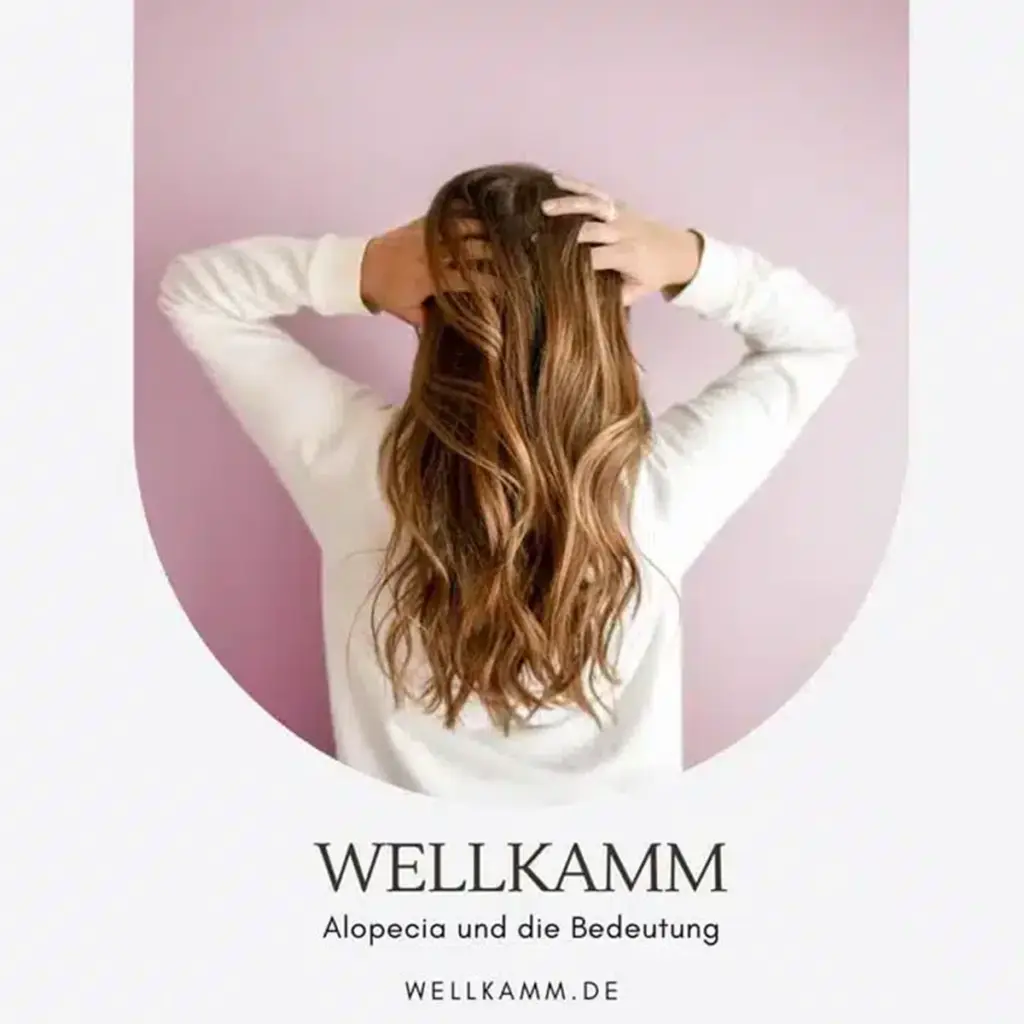 Alopecia und die Bedeutung Haarausfall